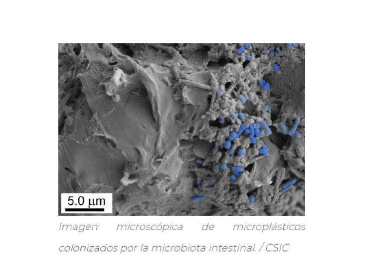 Un estudio demuestra que la ingesta de microplásticos altera la microbiota intestinal